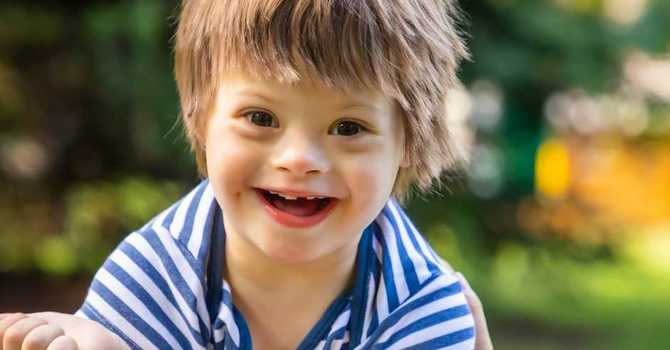 The Role of Physical Therapy in Treating Individuals with Down Syndrome